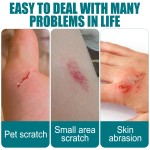 Skin Repair Dressing Factory - Transparent Waterproof Bandage