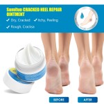 Foot Repair Cream Supplier - Herbal Cracked Heel Care