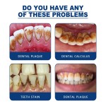 Oral Spray Supplier - Dental Calculus Bad Breath Dissolving