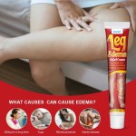 Edema Cream Supplier - Natural Herbal Swelling Elimination