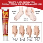 Edema Cream Supplier - Natural Herbal Swelling Elimination