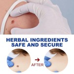 Wart Removal Factory - Ointment Skin Tag Corns Gel