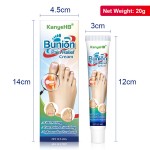 Joint Pain Ointment Manufacturer - Toe Valgus Hand Wrist