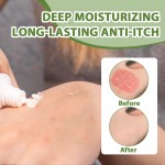 Eczema Cream Supplier - Tea Tree Oil Anti-itching Care