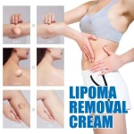 Lipoma Cream Supplier - Portable Skin Care Lotion
