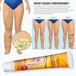 Lymphatic Detox Cream Supplier - Neck Armpit Swelling Pain