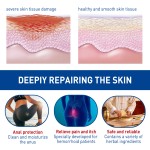 Hemorrhoids Capsules Supplier - OEM Internal External Relief