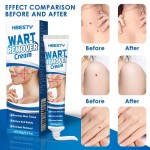 Verruca Cream Supplier - Warts Skin Tag Care Plaster