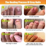 Nail Fungus Cream Factory - Strong Feet Treatment Repair