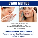 Warts Remover Supplier - Herbal Extract Skin Tag Treatment