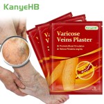 Varicose Veins Patch Factory - Leg Vasculitis Phlebitis Plaster