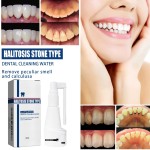 Oral Spray Supplier - Dental Calculus Bad Breath Dissolving