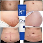 Scar Removal Cream Factory - Acne Spots Burn Repair