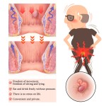 Hemorrhoids Capsules Supplier - OEM Internal External Relief