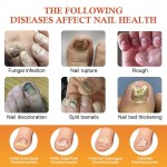 Nail Fungus Cream Factory - Strong Feet Treatment Repair