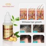 Hair Growth Oil Factory - Ginger Regrowth Treatment Serum