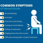 Herbal Capsules Factory - 7pcs Hemorrhoid Pain Relief