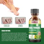 Toenail Solution Manufacturer - Tea Tree Fungus Sterilization