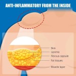 Lipoma Cream Supplier - Portable Skin Care Lotion