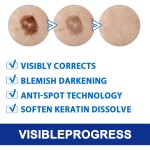 Warts Remover Supplier - Herbal Extract Skin Tag Treatment