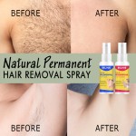 Hair Removal Spray Factory - Unisex Gentle Natural Cleansing