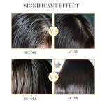 Hair Growth Set Supplier - Organic Ginger Anti Hair Loss