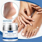Foot Cream Factory - Private Label Dry Cracked Skin Whitening