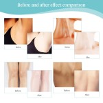 Intimate Whitening Manufacturer - Vaginal Lips Underarm Care