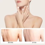 Bikini Whitening Lotion Factory - Woman Black Parts Removal