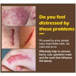 Whitening Cream Manufacturer - Private Label Inner Thigh Lightening