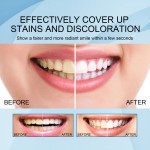 Teeth Whitening Pen Factory - Professional Gel Pen