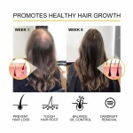 Essential Oil Manufacturer - 30ml Hair Growth Nourish