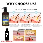 Hair Growth Shampoo Factory - Organic Flower Anti Hair Loss