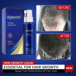 Hair Growth Oil Manufacturer - Private Label Bulk Organic Vitamin