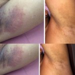 Whitening Cream Factory - OEM 7 Days Private Parts Strongest