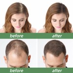 Hair Growth Essence Factory - OEM Wholesale Nourish Scalp 30ml