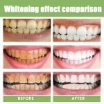 Tooth Whitening Strips Manufacturer - OEM New High Adhesion Day