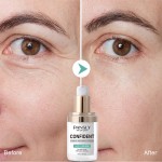 Eye Serum Manufacturer - OEM 30ml Milia Remover Essential