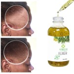 Scalp Elixirs Manufacturer - Custom Logo Organic Formula Wholesale