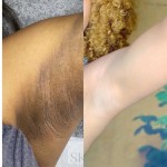 Whitening Cream Factory - OEM 7 Days Private Parts Strongest