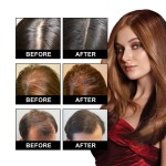 Essential Oil Manufacturer - 30ml Hair Growth Nourish