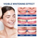 Teeth Whitening Serum Factory - Private Label Brightening Stain Removal