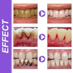 Whitening Toothpaste Supplier - Fresh Breath Stain Removal