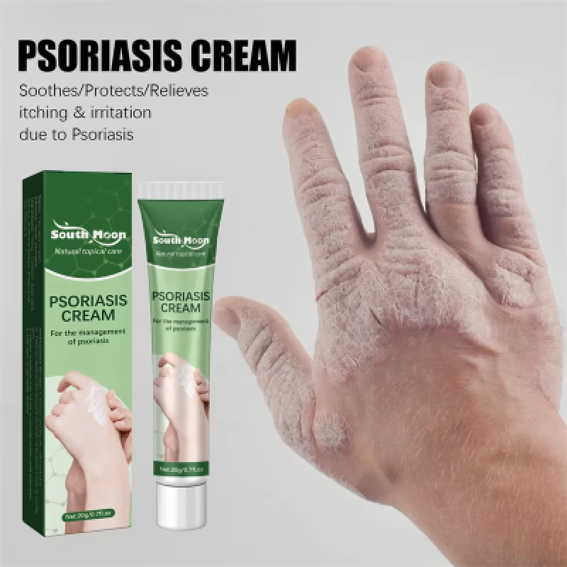 Psoriasis Cream Manufacturer - OEM Anti Itch Dermatitis Relief