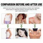 Foot Cream Factory - OEM Heel Moisturizing Anti Dry Cracking