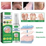 Antifungal Spray Manufacturer - Hand Foot Care Medicine Gentle Formula