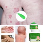 Skin Repair Cream Factory - Wholesale 30g Herbal Organic Anti Itch