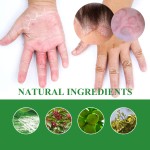 Skin Repair Cream Factory - Wholesale 30g Herbal Organic Anti Itch
