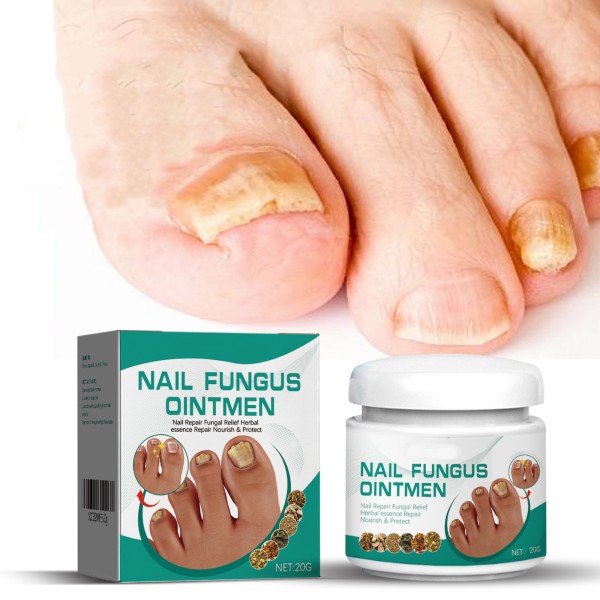Nails Fungus Cream Manufacturer - Fungal Foot Toe Nails Gel Care