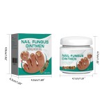 Nails Fungus Cream Manufacturer - Fungal Foot Toe Nails Gel Care
